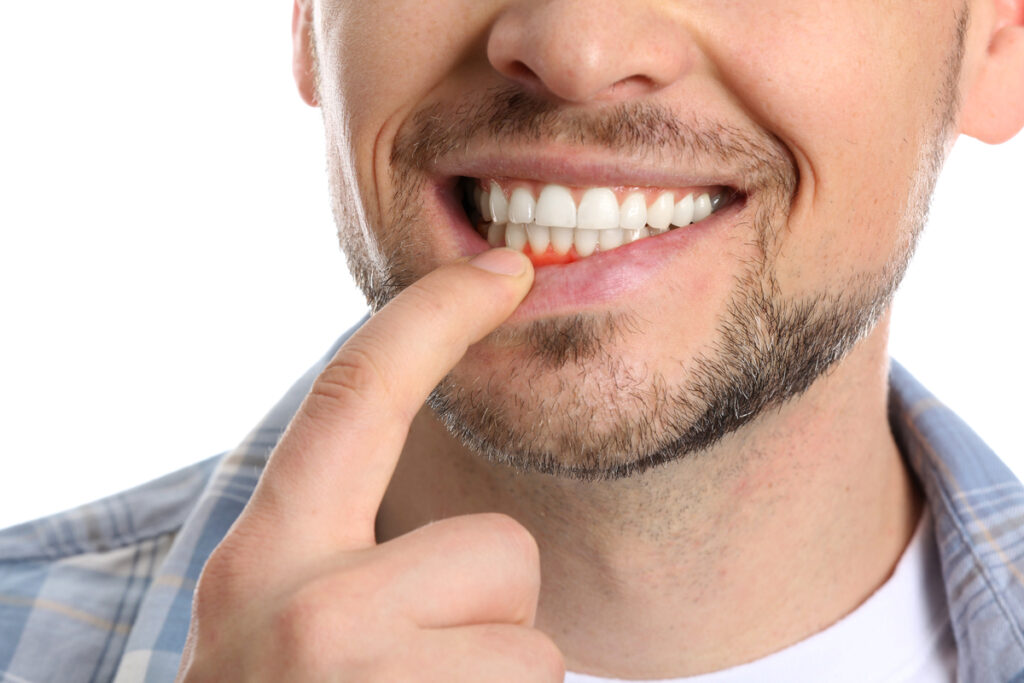 prevent gum disease, best dental care clinic scottsdale az