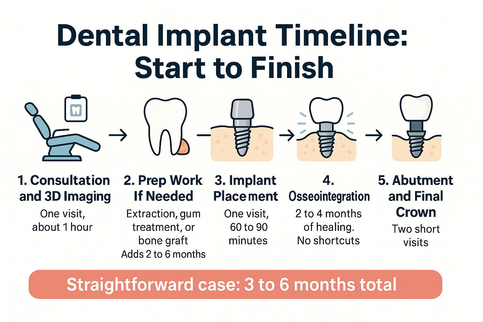 How Long Does a Dental Implant Take From Start to Finish? 2 Infographic showing the five stages of a dental implant timeline from consultation to final crown